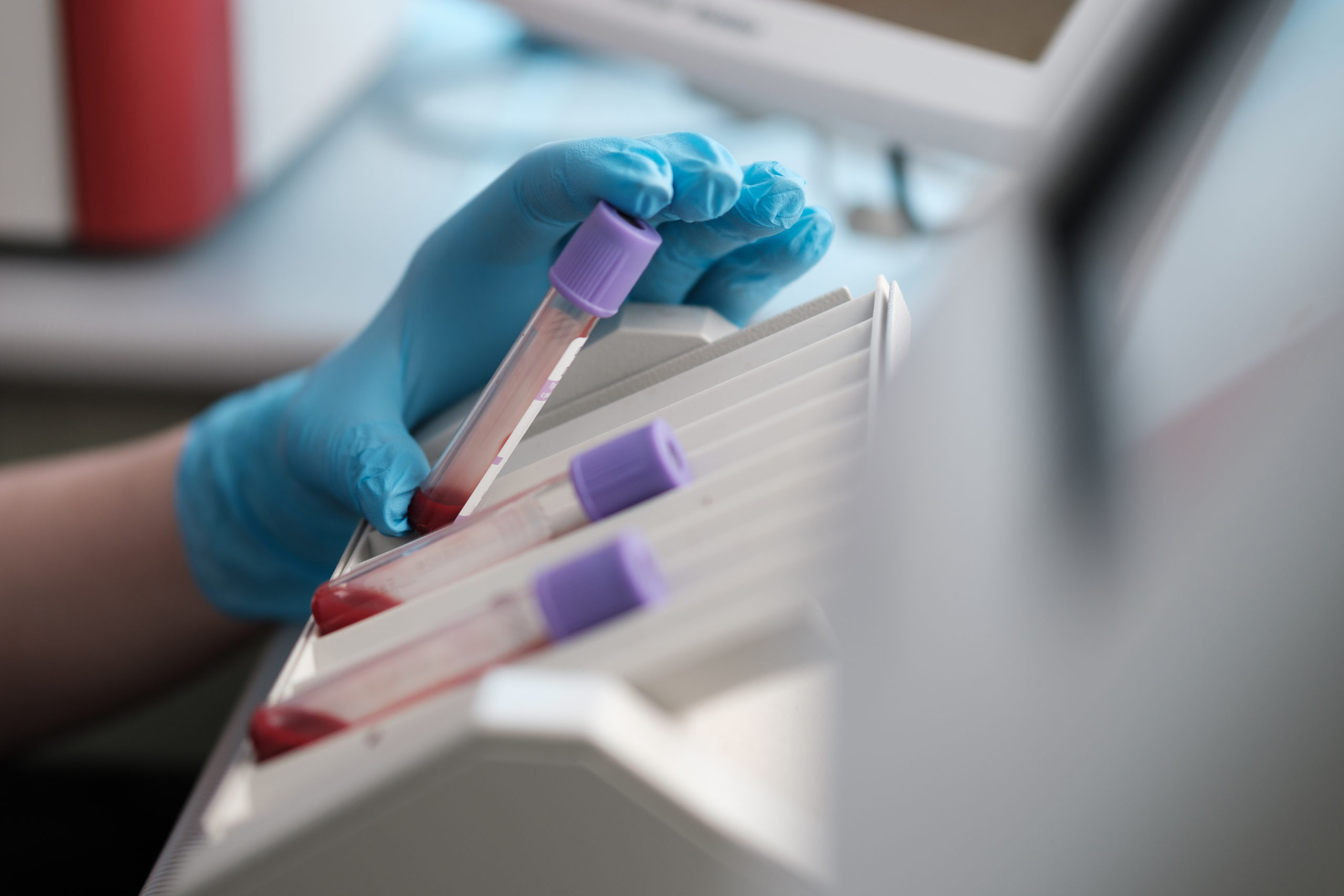 Scientist working with microscope, laboratory beakers, test tubes, pipettes. Scientist working with microscope, laboratory beakers, test tubes, pipettes.
